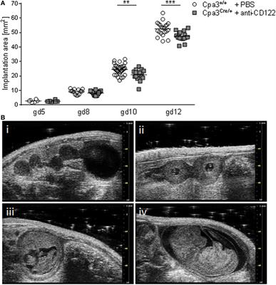 Simultaneous Ablation of Uterine Natural Killer Cells and Uterine Mast Cells in Mice Leads to Poor Vascularization and Abnormal Doppler Measurements That Compromise Fetal Well-being